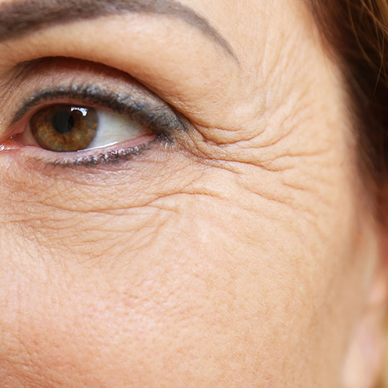 Ageing and Fine Lines